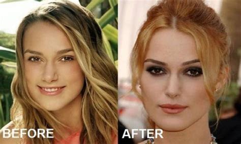 Keira Knightley, Before and After .